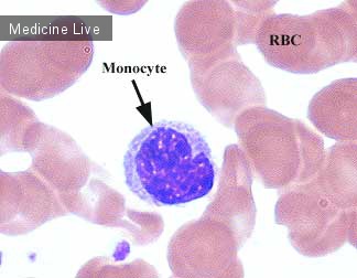 Гематология: моноцит