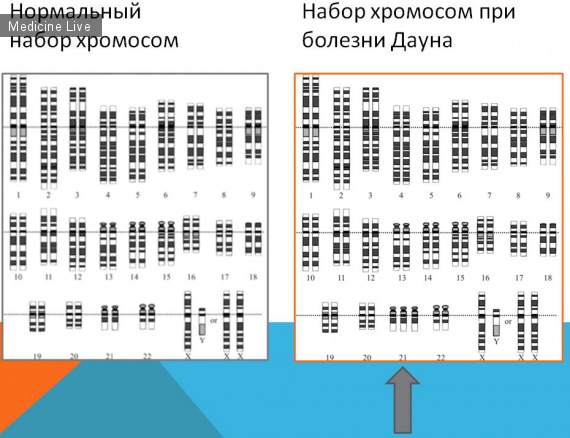 Генетика: Наследственно-дегенеративные заболевания нервной системы