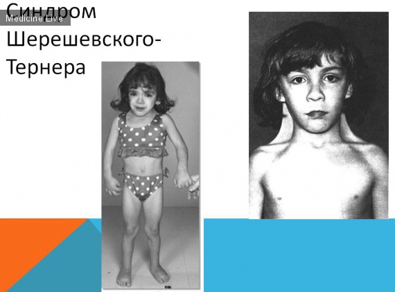 Генетика: Наследственно-дегенеративные заболевания нервной системы