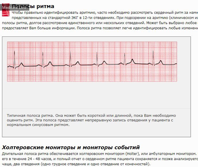 Внутренние болезни: Обновление: Все что нужно для понимания ЭКГ (M.Thaler, 2006)