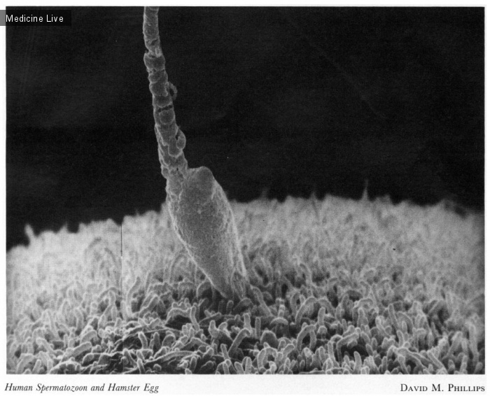 Красивые фотографии: Человеческий сперматозоид и яйцеклетка хомяка