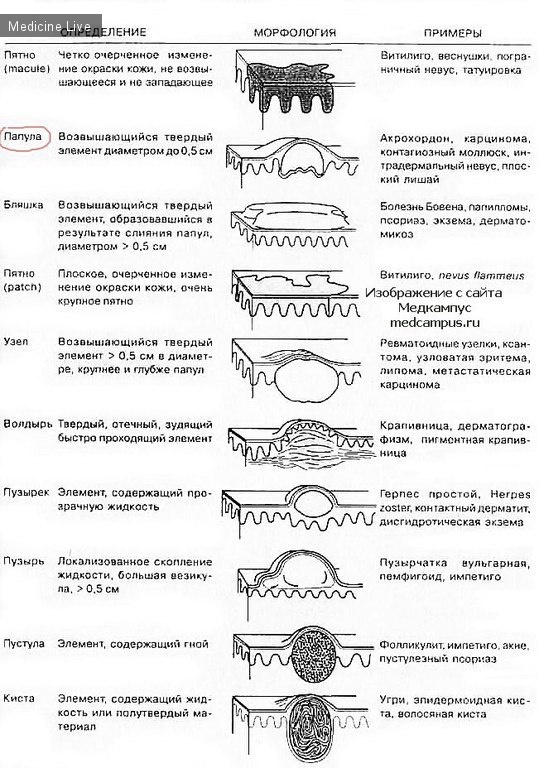 Дерматовенерология: Первичные морфологические элементы