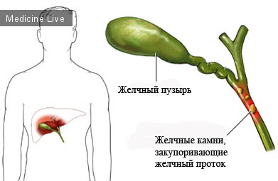 Хирургия - лекция 6 - Воспалительные заболевания органов брюшной полости