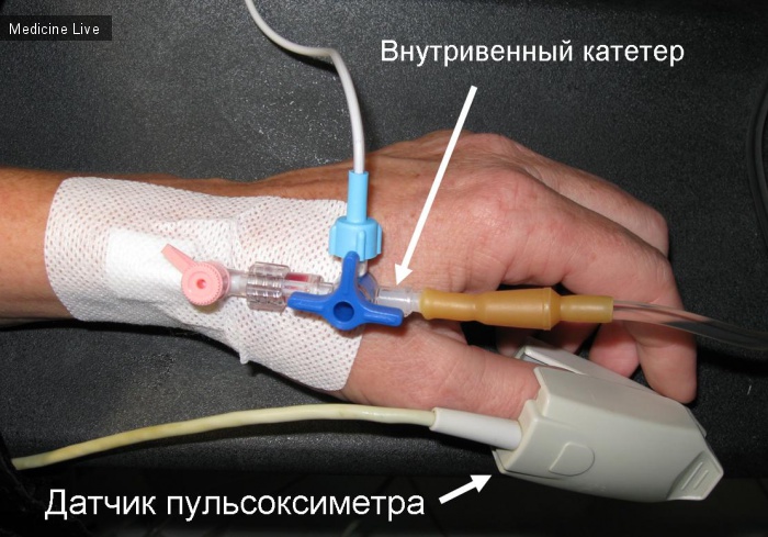 Хирургия - лекция 13 - обезболивание