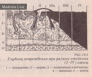 Хирургия - лекция 19 - Термические повреждения