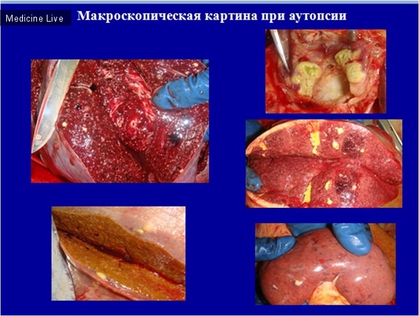 Патанатомия: Сгореть за 8 часов