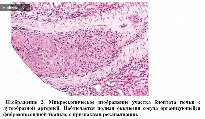 Интересный случай: A Hard Diagnosis