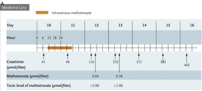 Интересный случай: Острая кристаллическая нефропатия, вызванная приемом метотрексата