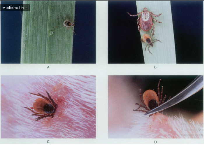 Полезные материалы: Переносчик спирохеты болезни Лайма.