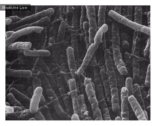 Интересный случай: Clostridium difficile